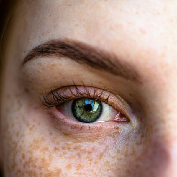 Post-Pregnancy and Hyperpigmentation: How to Fade Dark…