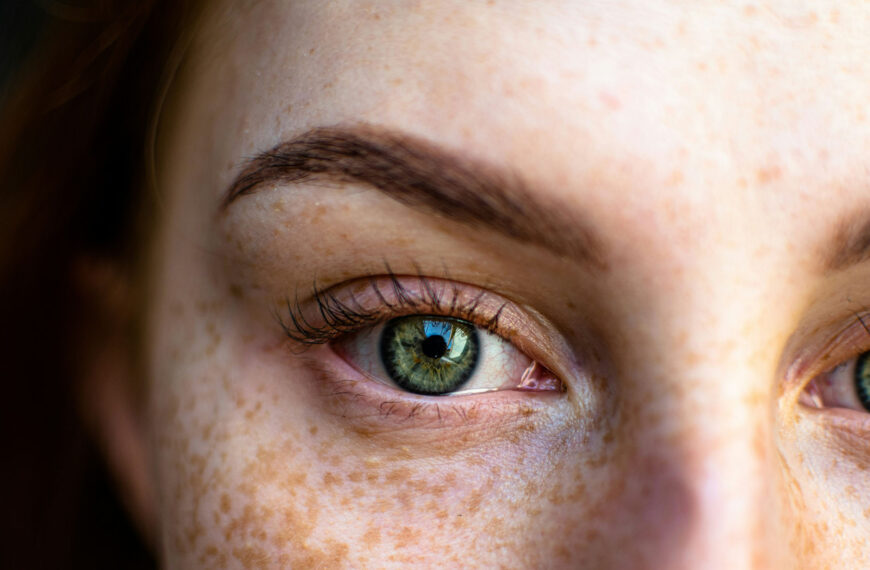 Post-Pregnancy and Hyperpigmentation: How to Fade Dark Spots After Giving Birth